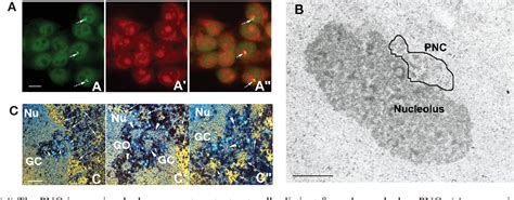 The Perinucleolar Compartment: RNA Metabolism and Cancer.